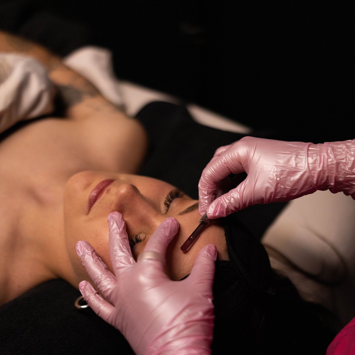 Dermaplaning
